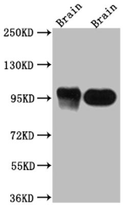 Western Blot. Positive WB detected in: Rat Brain whole cell lysate, Mouse Brain whole cell lysate. All lanes: PSD95 antibody at 1:1000. Secondary. Goat polyclonal to rabbit IgG at 1/50000 dilution. Predicted band size: 81, 86, 81 kDa. Observed band size: 95 kDa. 