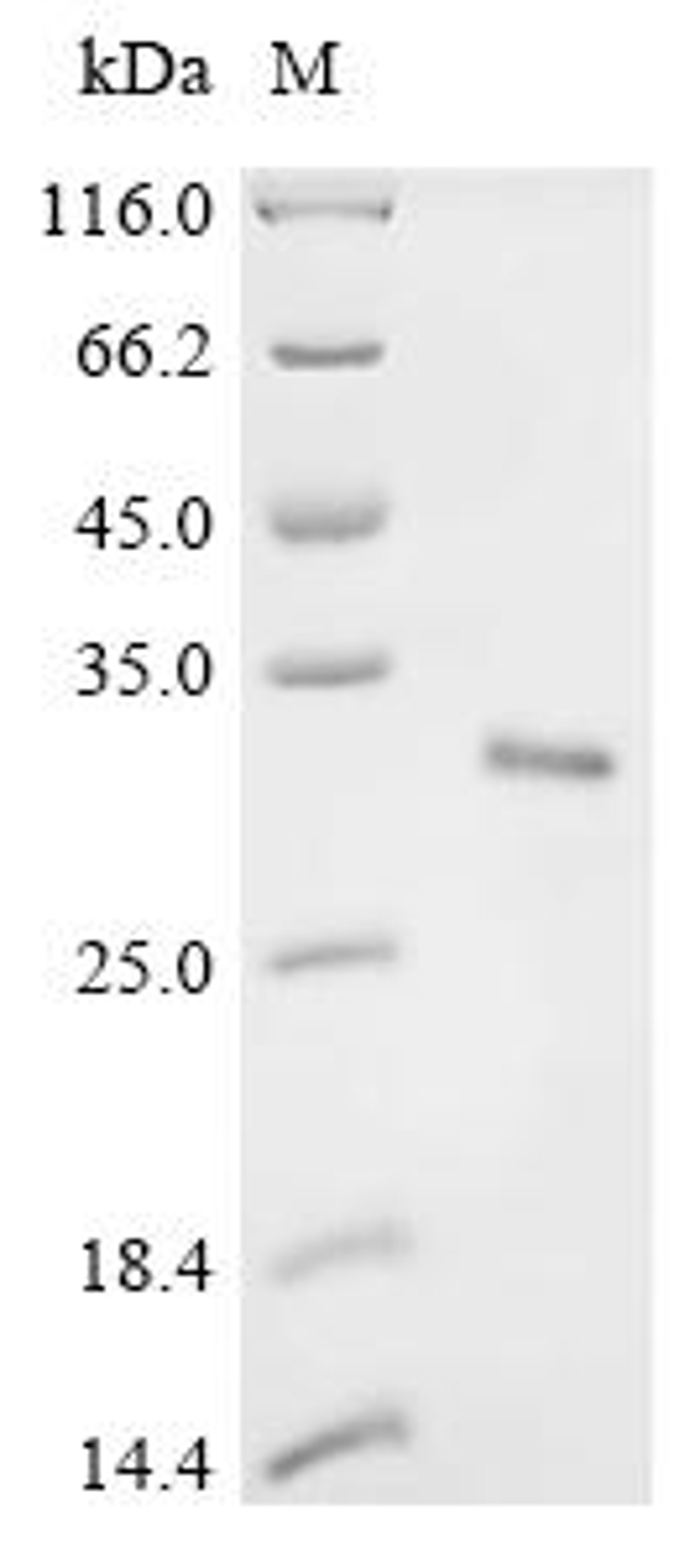 (Tris-Glycine gel) Discontinuous SDS-PAGE (reduced) with 5% enrichment gel and 15% separation gel.