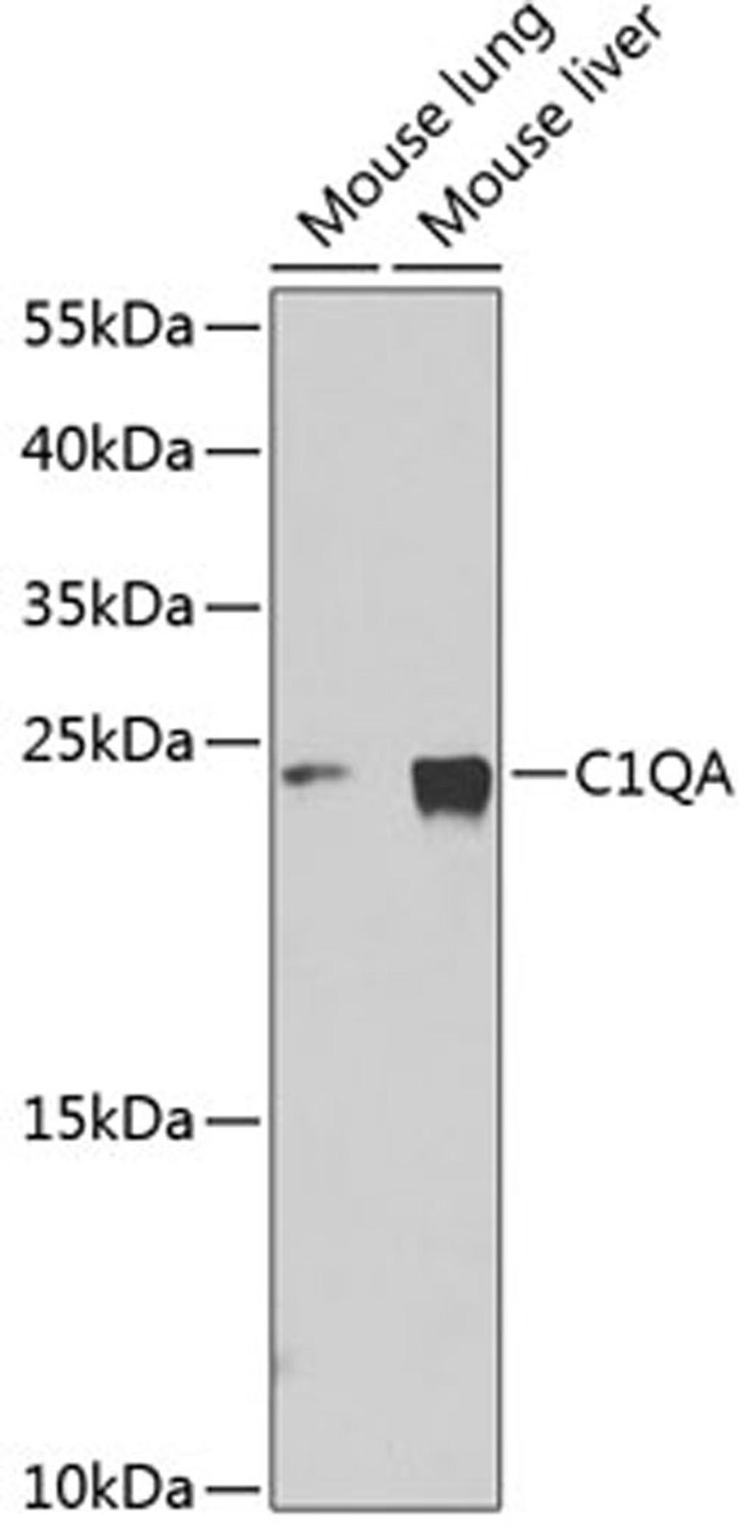 Western blot - C1QA Antibody (A1821)