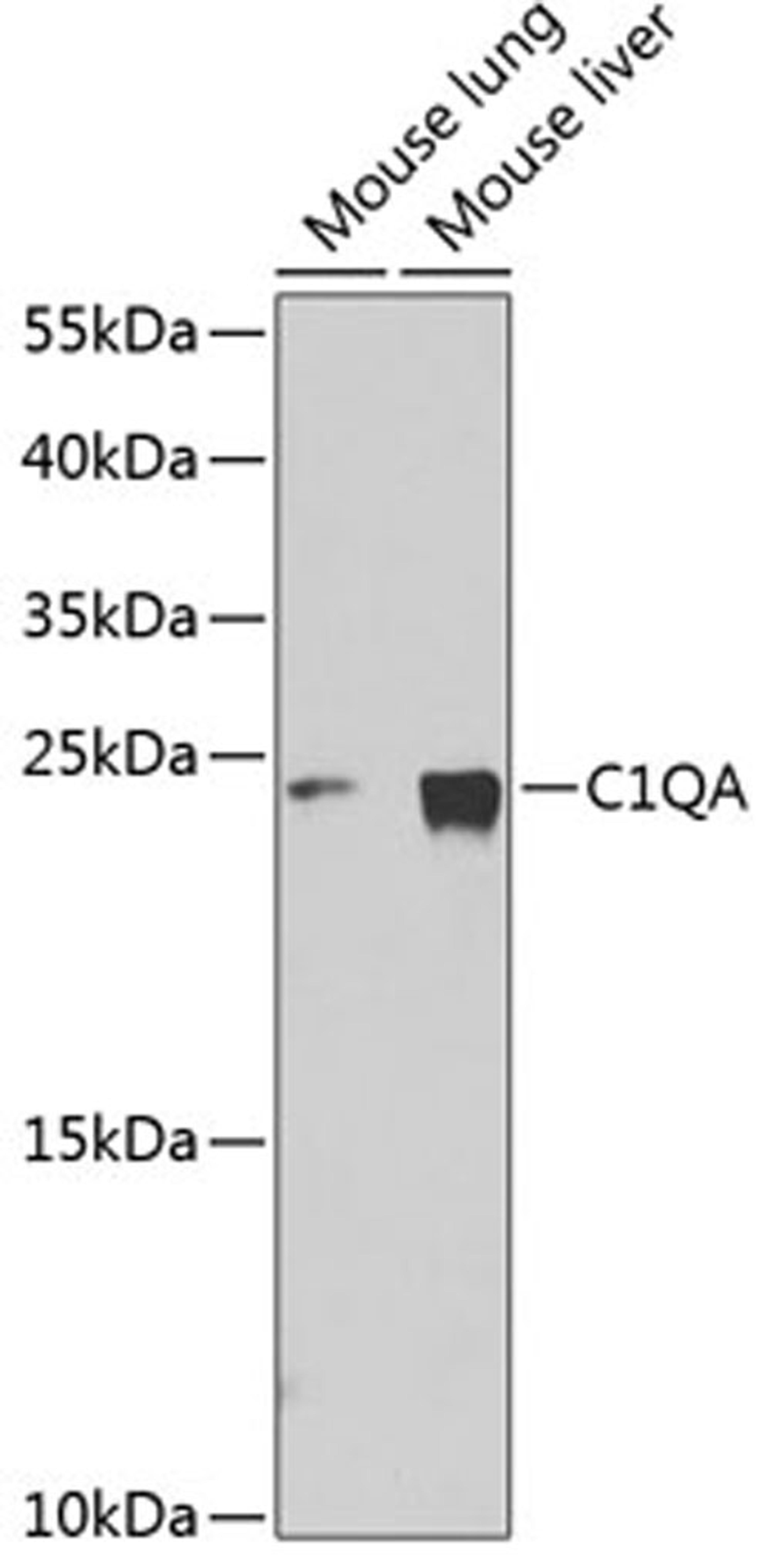 Western blot - C1QA Antibody (A1821)