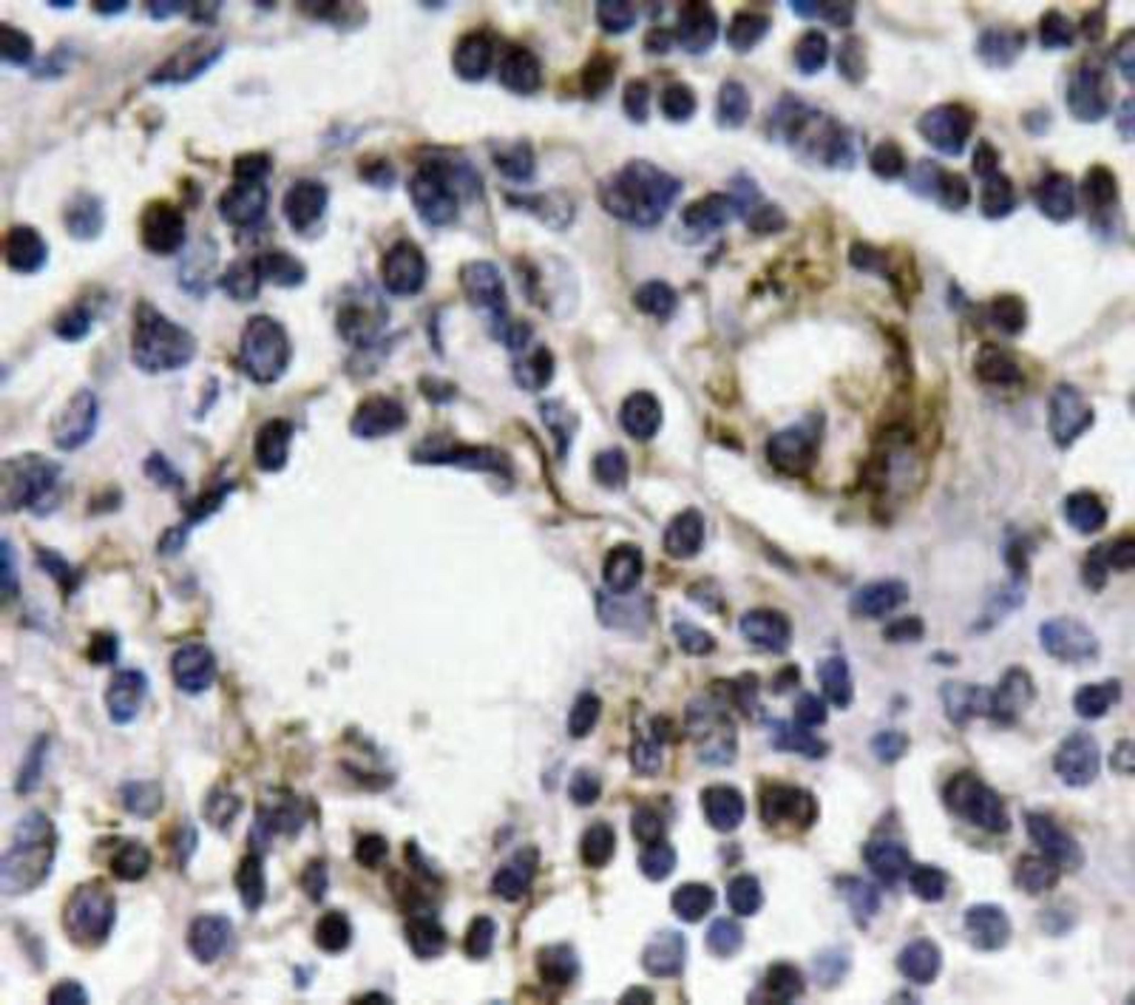 Immunohistochemistry-Paraffin: IFN-gamma Antibody [NBP1-19761] -  Paraffin-embedded human lymph node tissue.