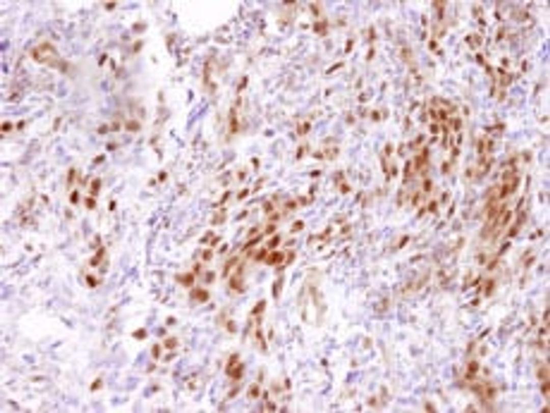 Detection of human CARM1 by immunohistochemistry.