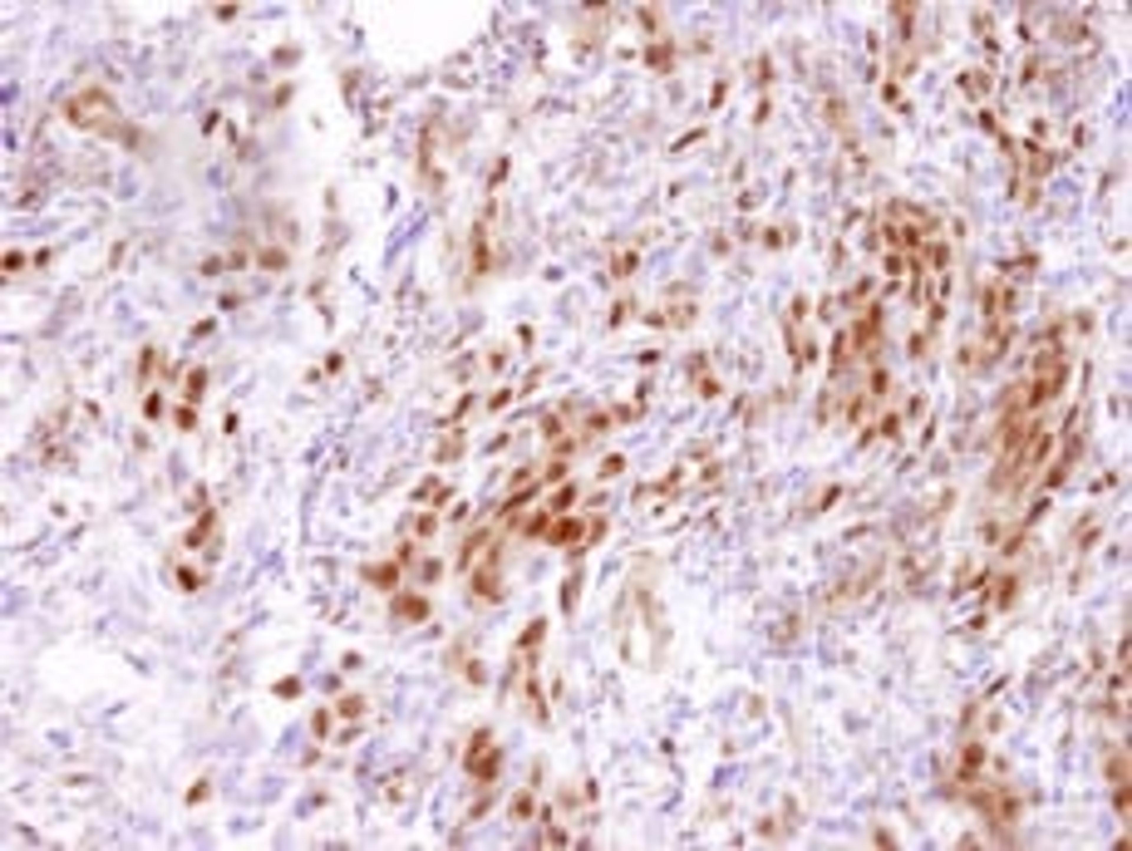 Detection of human CARM1 by immunohistochemistry.