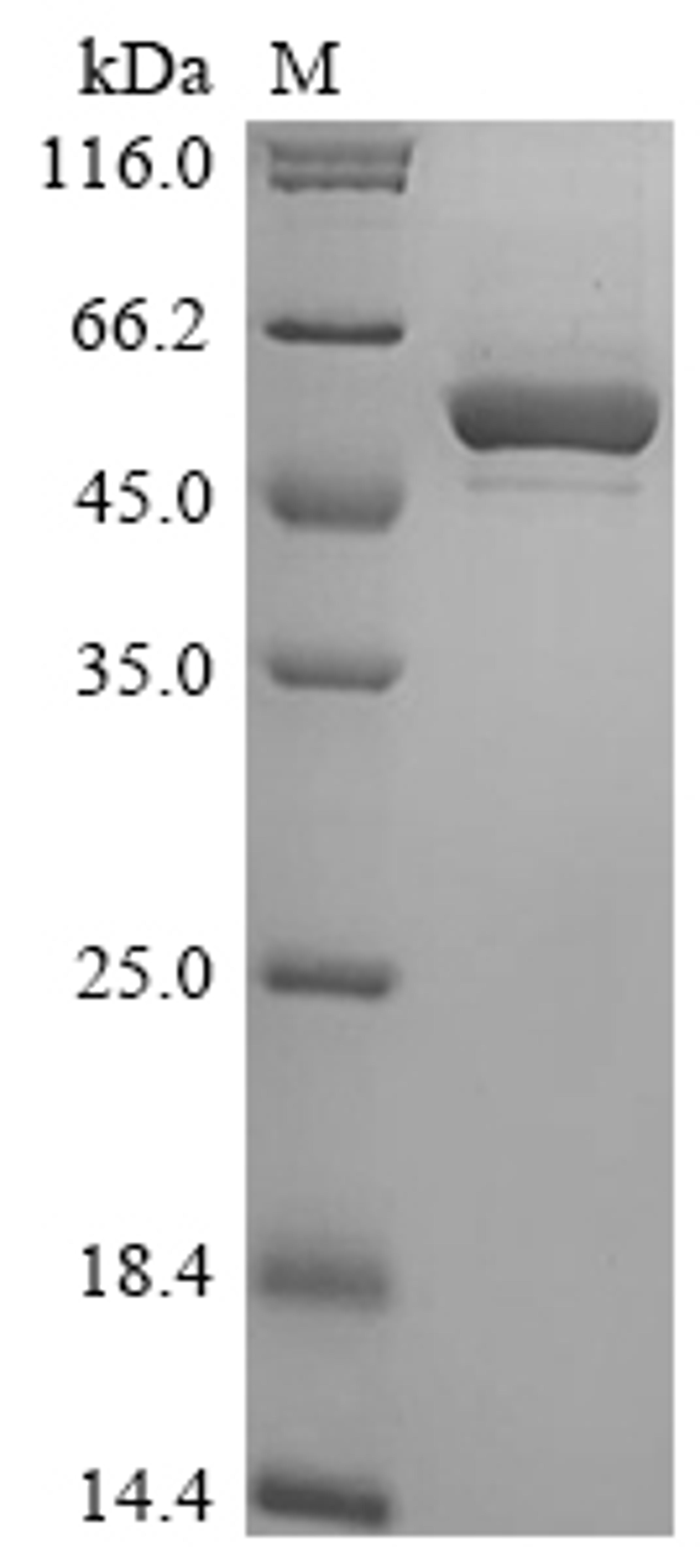 (Tris-Glycine gel) Discontinuous SDS-PAGE (reduced) with 5% enrichment gel and 15% separation gel.
