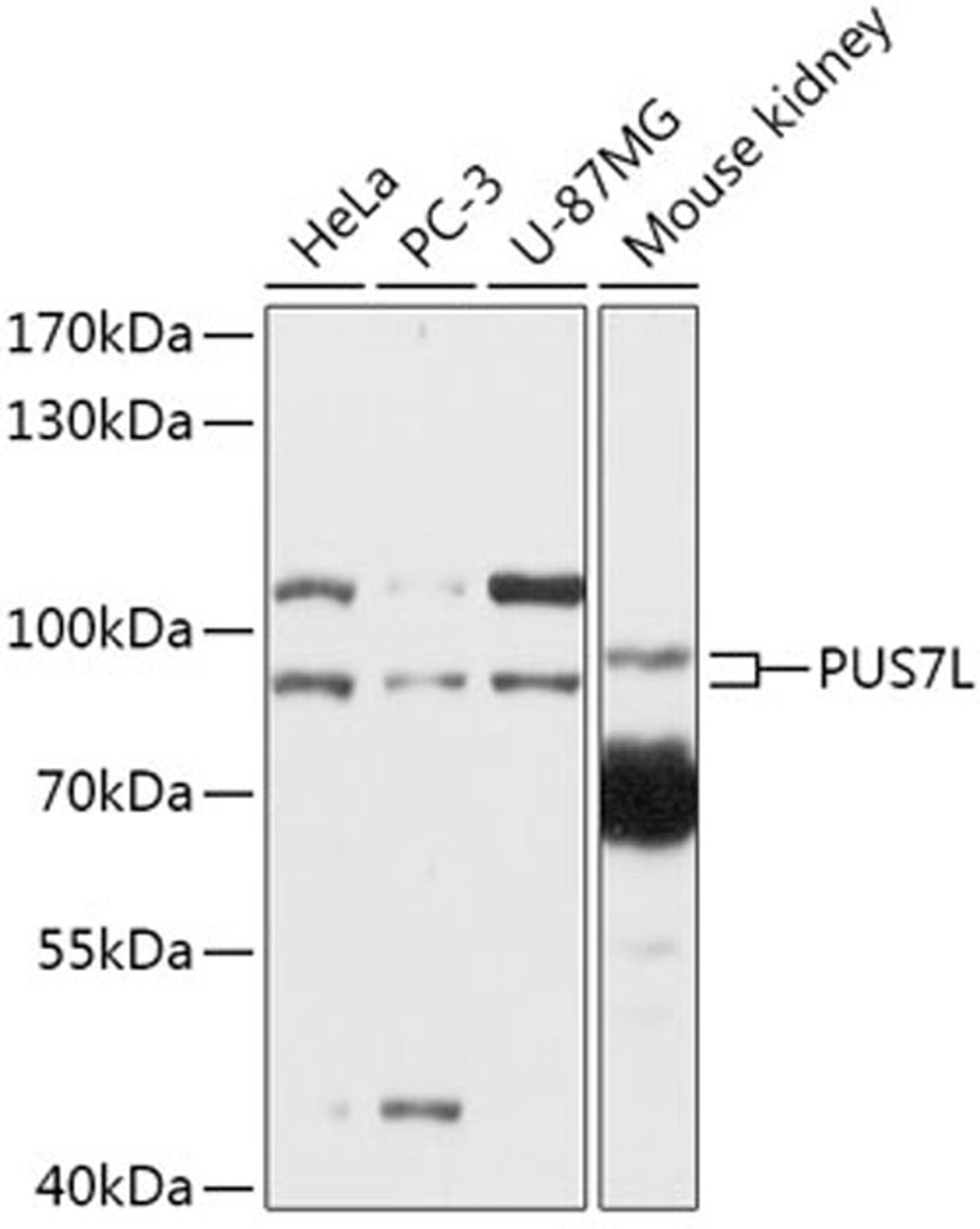 Western blot - PUS7L antibody (A17783)