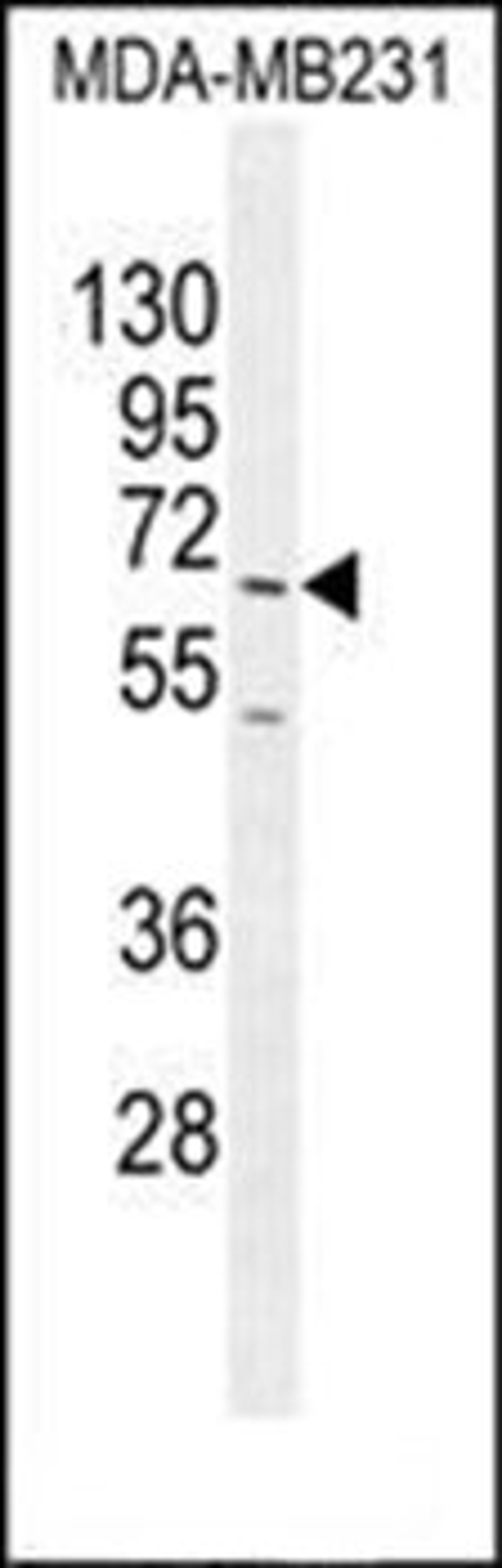 Western blot analysis of MDA-MB231 cell line lysates (35ug/lane) using FUT8 antibody (Center)