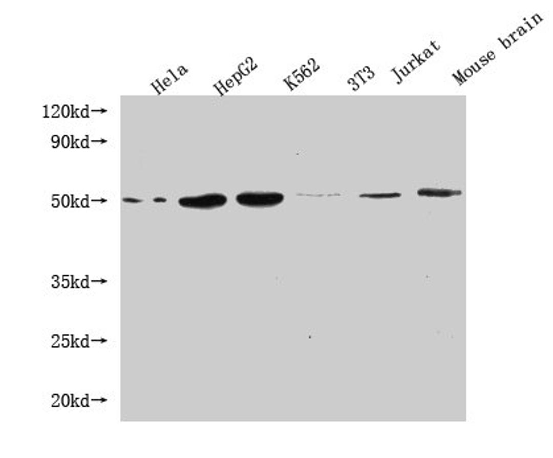 Western Blot. Positive WB detected in: Hela whole cell lysate, HepG2 whole cell lysate, K562 whole cell lysate, 3T3 whole cell lysate, Jurkat whole cell lysate, Mouse brain tissue. All lanes: FLOT1 antibody at 1:1000. Secondary. Goat polyclonal to mouse IgG at 1/50000 dilution. Predicted band size: 48, 43 kDa. Observed band size: 48 KDa. Exposure time：5min