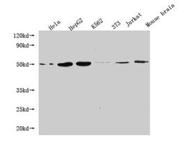 Western Blot. Positive WB detected in: Hela whole cell lysate, HepG2 whole cell lysate, K562 whole cell lysate, 3T3 whole cell lysate, Jurkat whole cell lysate, Mouse brain tissue. All lanes: FLOT1 antibody at 1:1000. Secondary. Goat polyclonal to mouse IgG at 1/50000 dilution. Predicted band size: 48, 43 kDa. Observed band size: 48 KDa. Exposure time：5min