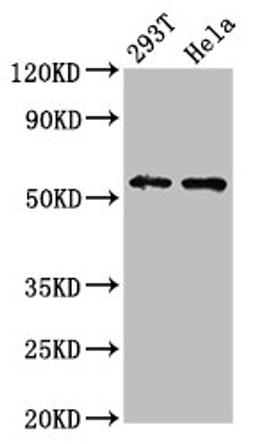 Western Blot. Positive WB detected in: 293T whole cell lysate, Hela whole cell lysate. All lanes: EPOR antibody at 4.3ug/ml. Secondary. Goat polyclonal to rabbit IgG at 1/50000 dilution. Predicted band size: 56, 27, 36 kDa. Observed band size: 56 kDa. 
