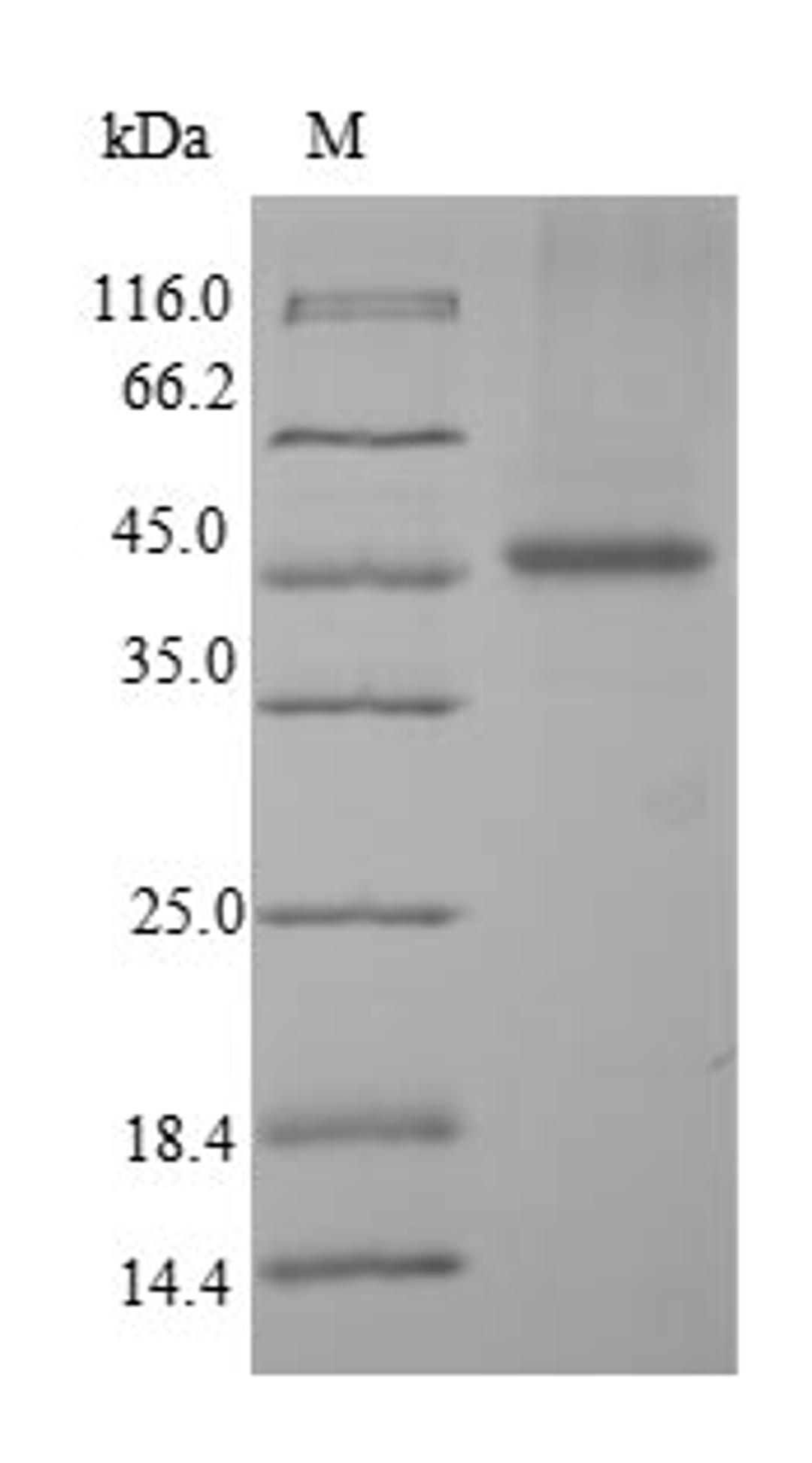 (Tris-Glycine gel) Discontinuous SDS-PAGE (reduced) with 5% enrichment gel and 15% separation gel.