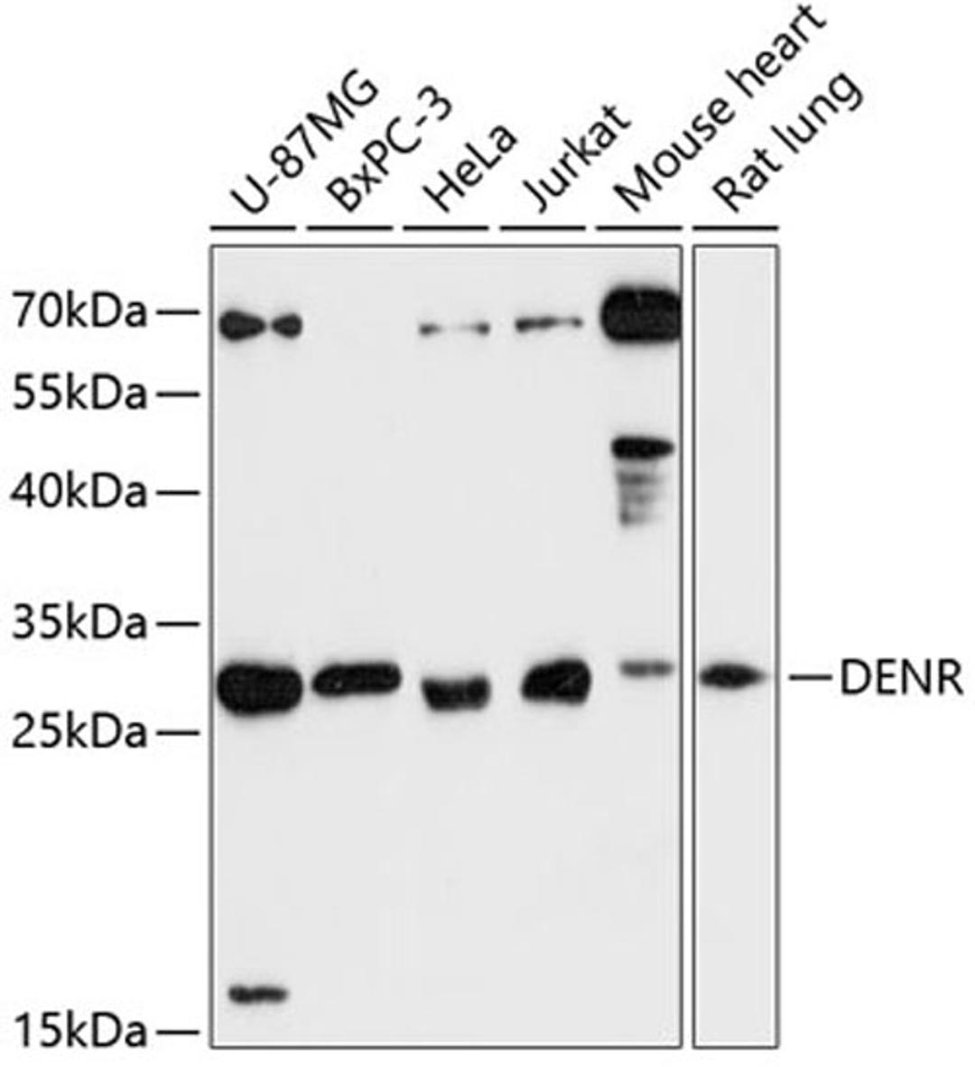 Western blot - DENR antibody (A13699)