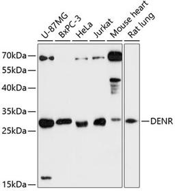 Western blot - DENR antibody (A13699)