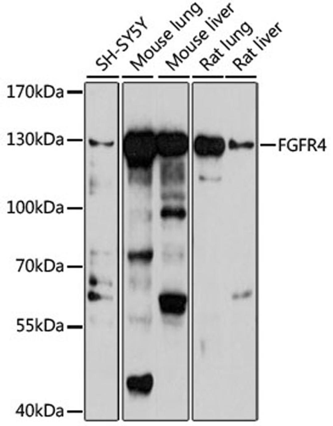 Western blot - FGFR4 antibody (A7555)