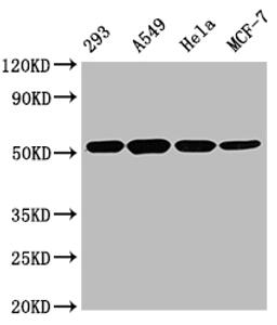 Western Blot. Positive WB detected in: 293 whole cell lysate, A549 whole cell lysate, Hela whole cell lysate, MCF-7 whole cell lysate. All lanes TUBB antibody at 1:5000. Secondary. Goat polyclonal to mouse IgG at 1/50000 dilution. Predicted band size: 55 KDa. Observed band size: 55 KDa. Exposure time:5s