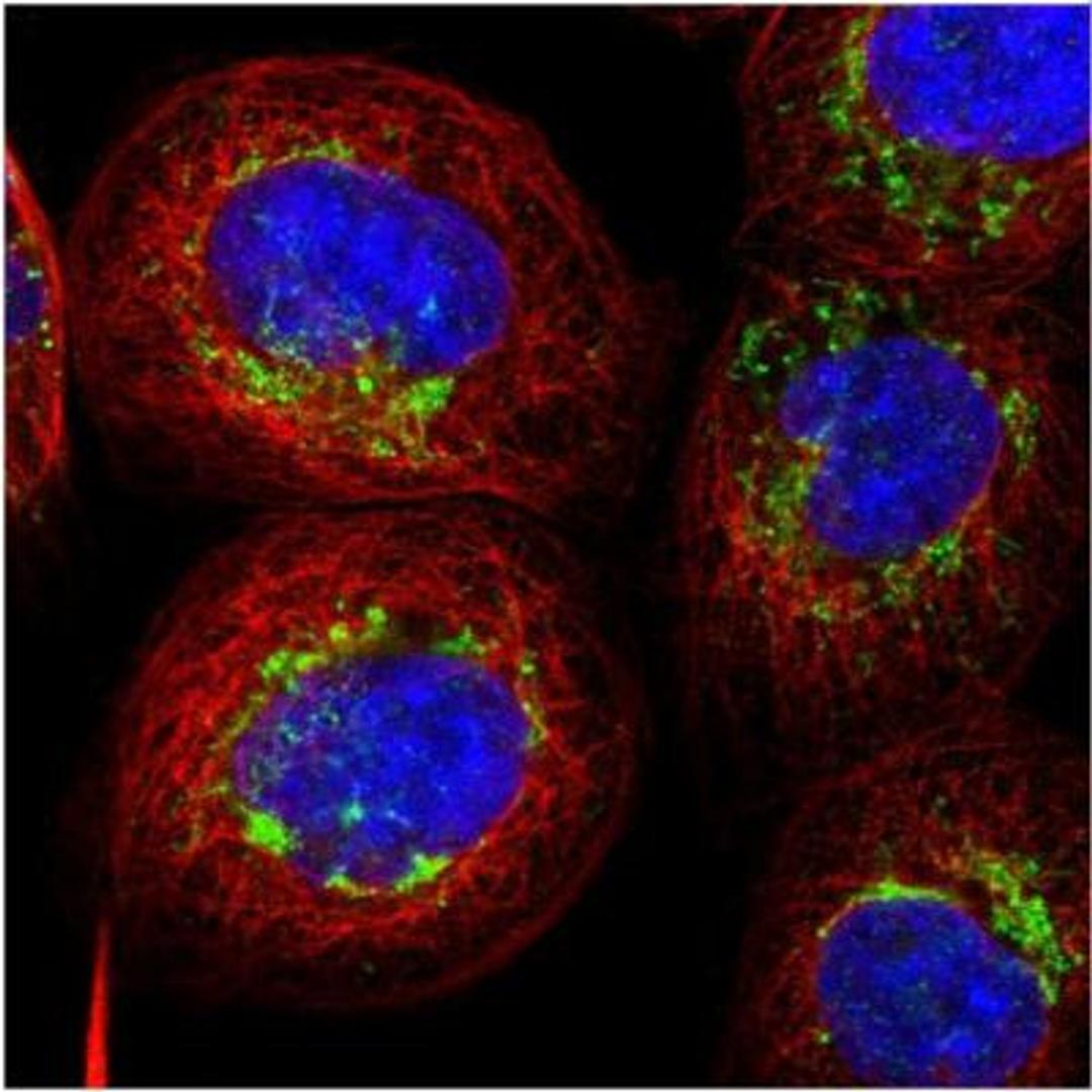 Immunocytochemistry/Immunofluorescence: AARS2 Antibody [NBP1-89323] - Immunofluorescent staining of human cell line A-431 shows positivity in mitochondria.