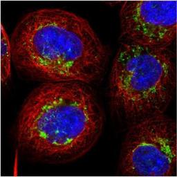 Immunocytochemistry/Immunofluorescence: AARS2 Antibody [NBP1-89323] - Immunofluorescent staining of human cell line A-431 shows positivity in mitochondria.