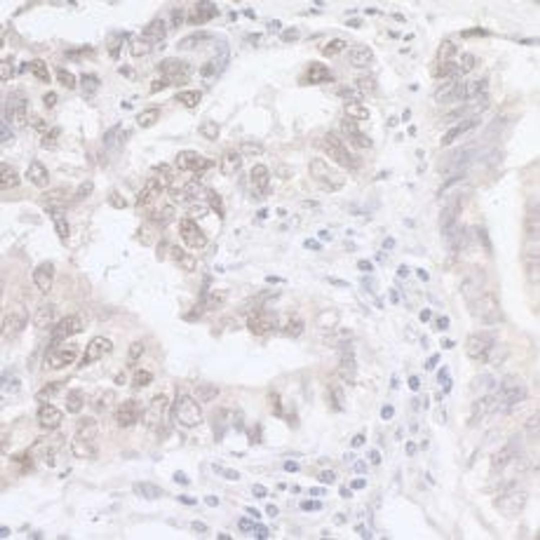 Detection of human ADAR1 by immunohistochemistry.