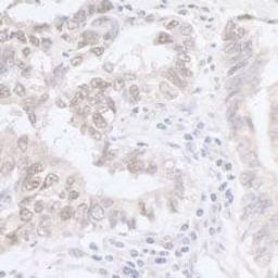 Detection of human ADAR1 by immunohistochemistry.