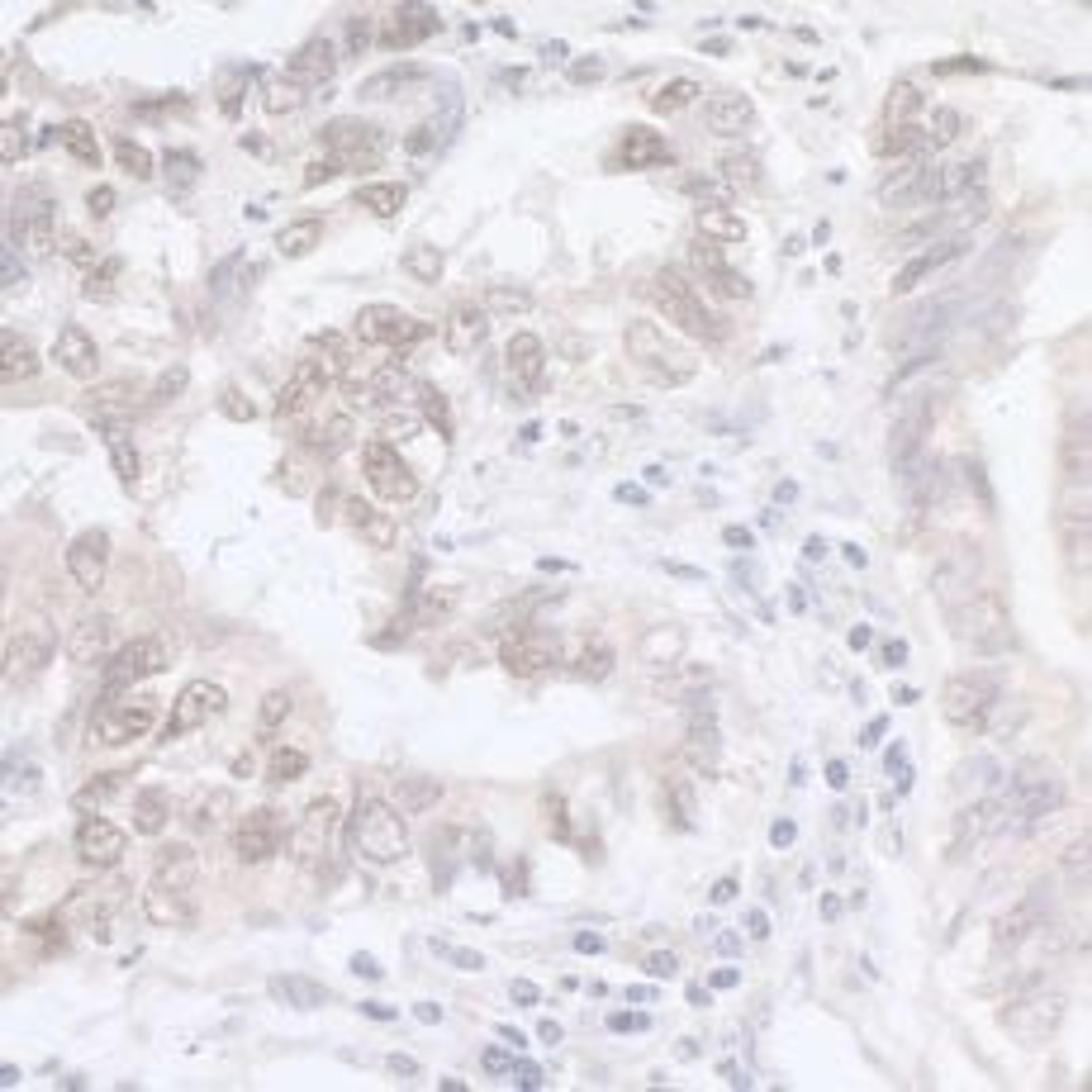 Detection of human ADAR1 by immunohistochemistry.