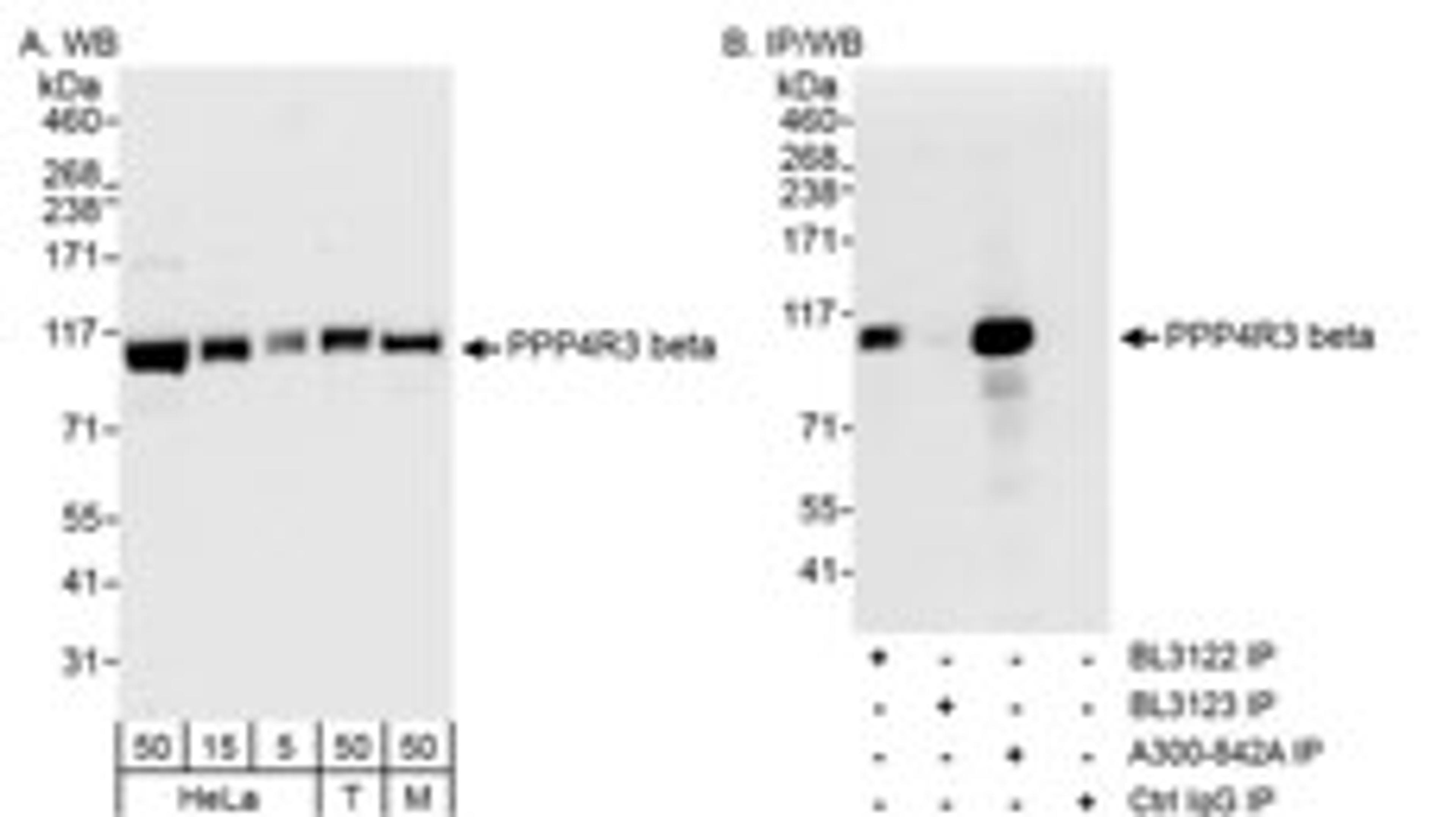 Detection of human and mouse PPP4R3 Beta by western blot (h&m) and immunoprecipitation (h).