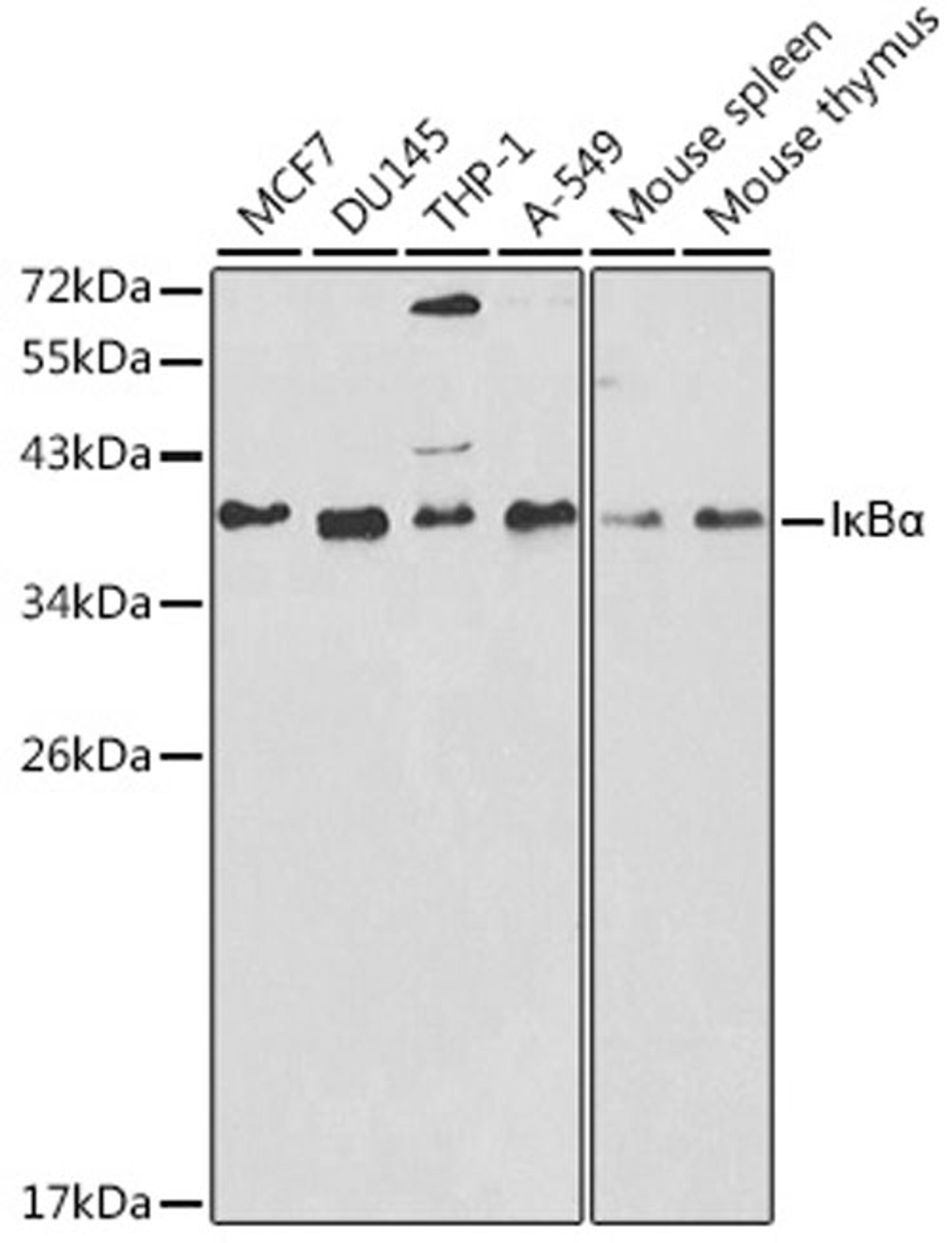 Western blot - I?Ba antibody (A11397)