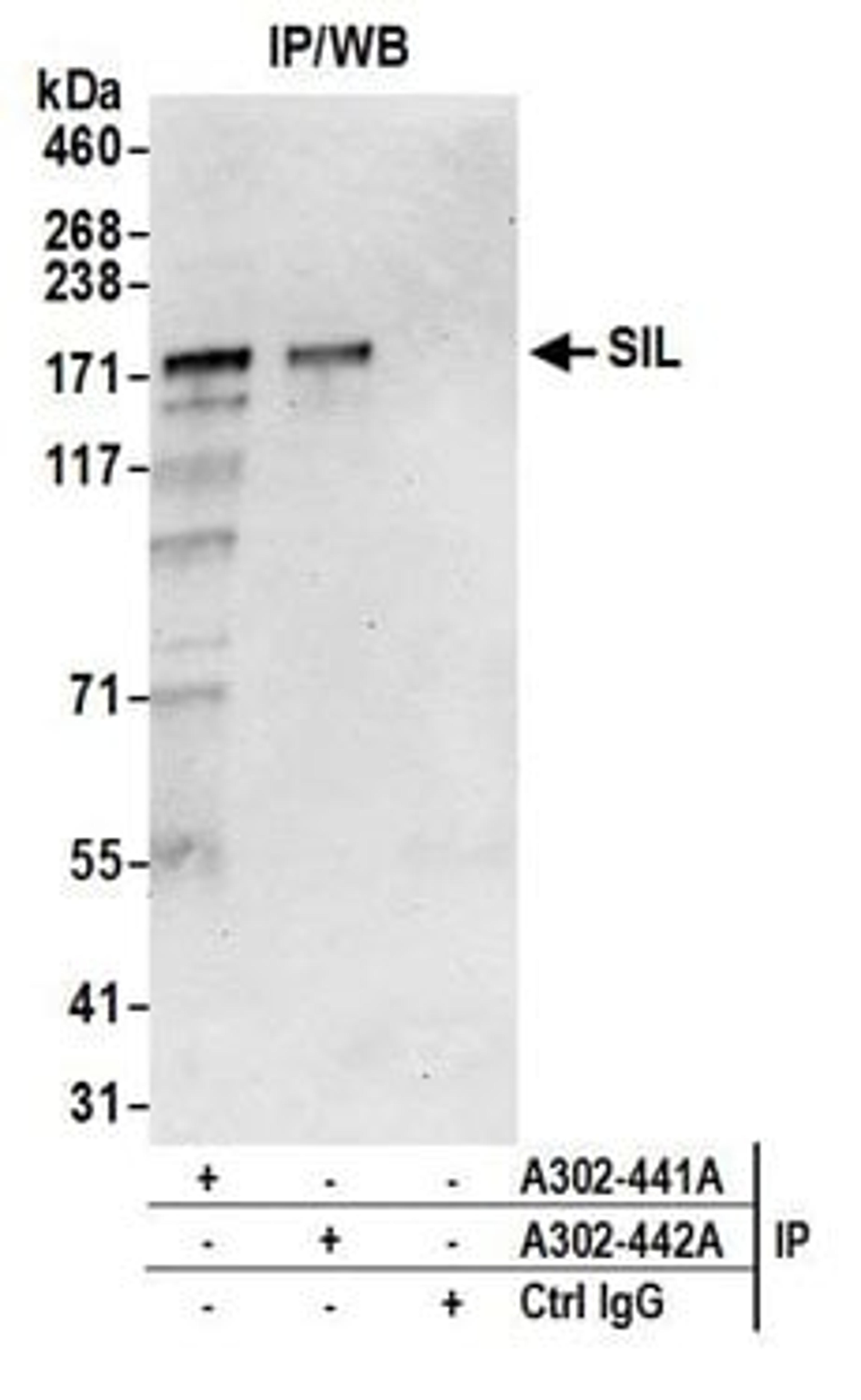 Detection of human SIL by western blot of immunoprecipitates.