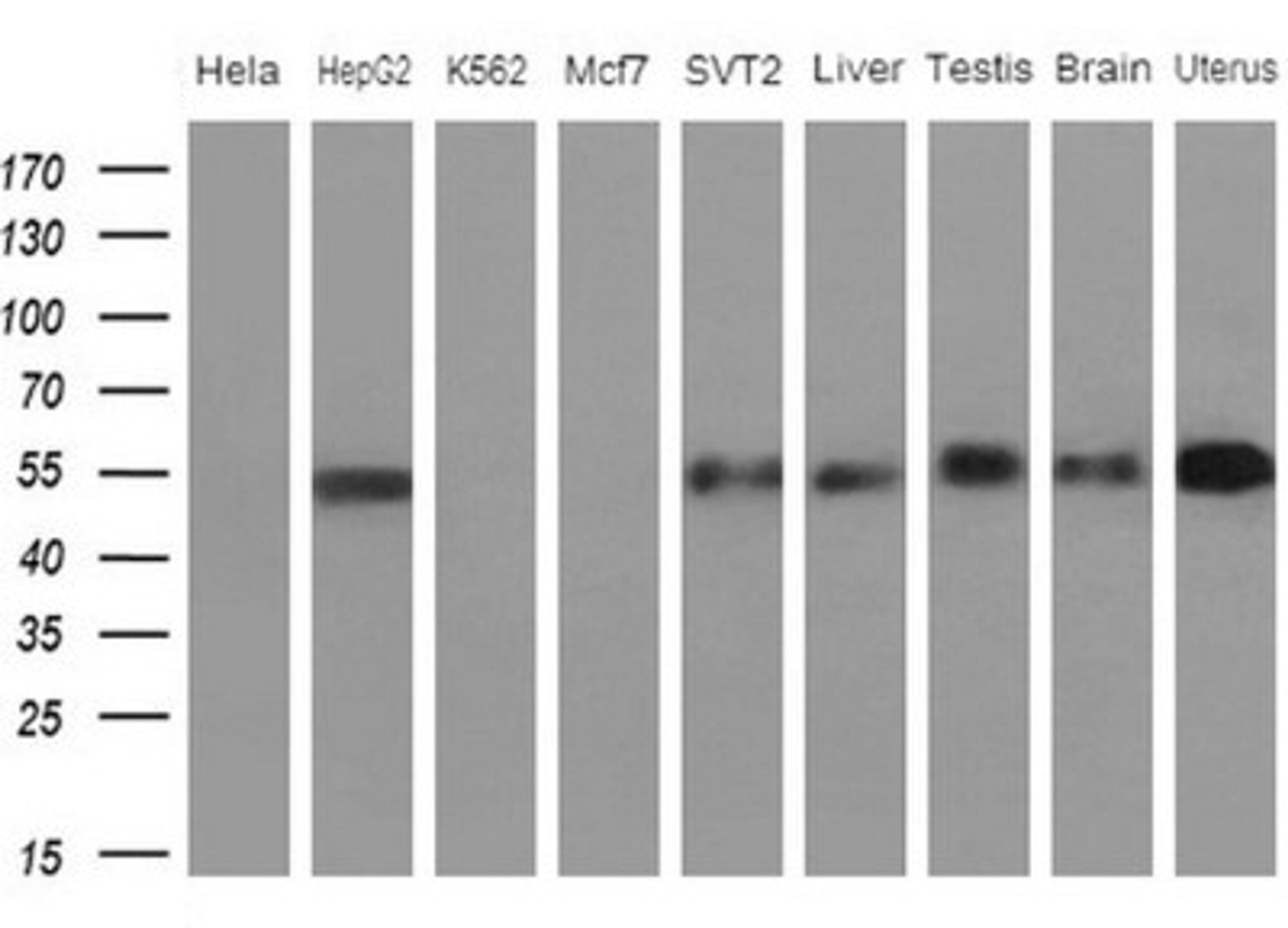 Western Blot: Apolipoprotein H/ApoH Antibody (4A11) [NBP2-46534] - Analysis of extracts (10ug) from 5 different cell lines and 4 human tissues(1: Hela; 2: HepG2; 3: K562; 4: Mcf7; 5: SVT2; 6: Liver; 7: Testis; 8: Brain; 9: Uterus)