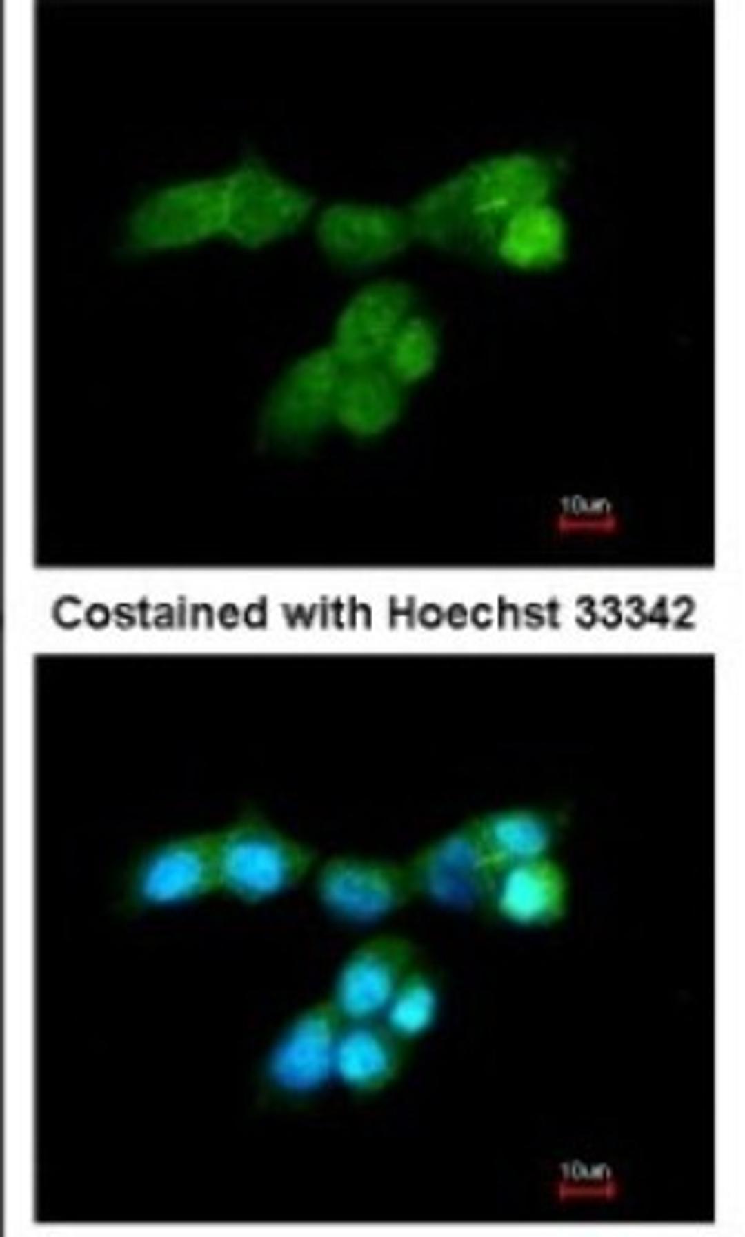 Immunocytochemistry/Immunofluorescence: DUSP10 Antibody [NBP1-31001] - Analysis of paraformaldehyde-fixed A431, using DUSP10 antibody at 1:200 dilution.