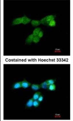 Immunocytochemistry/Immunofluorescence: DUSP10 Antibody [NBP1-31001] - Analysis of paraformaldehyde-fixed A431, using DUSP10 antibody at 1:200 dilution.