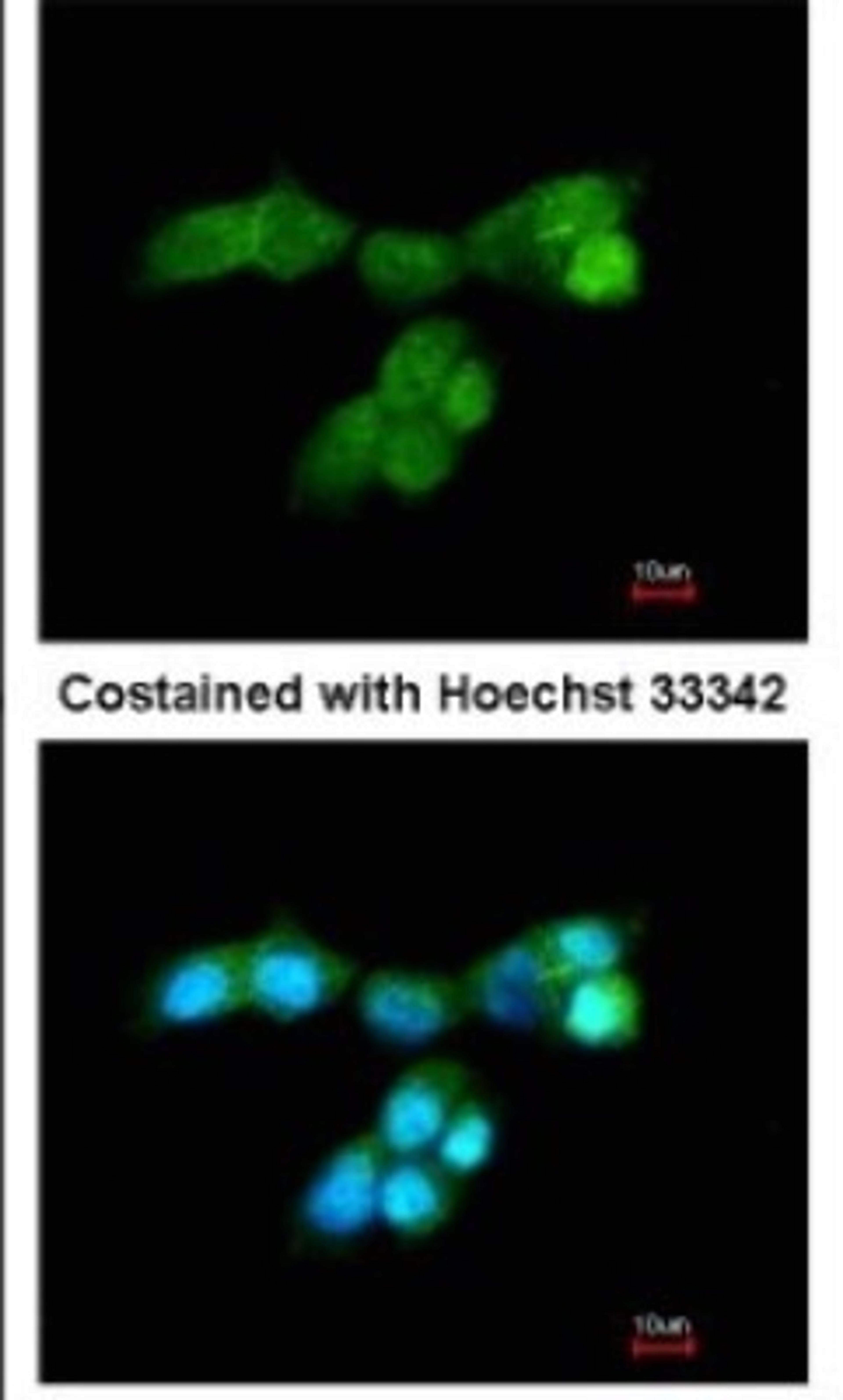 Immunocytochemistry/Immunofluorescence: DUSP10 Antibody [NBP1-31001] - Analysis of paraformaldehyde-fixed A431, using DUSP10 antibody at 1:200 dilution.