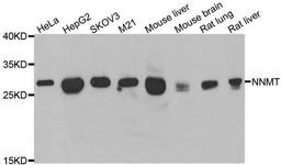 Western blot analysis of extracts of various cell lines using NNMT antibody