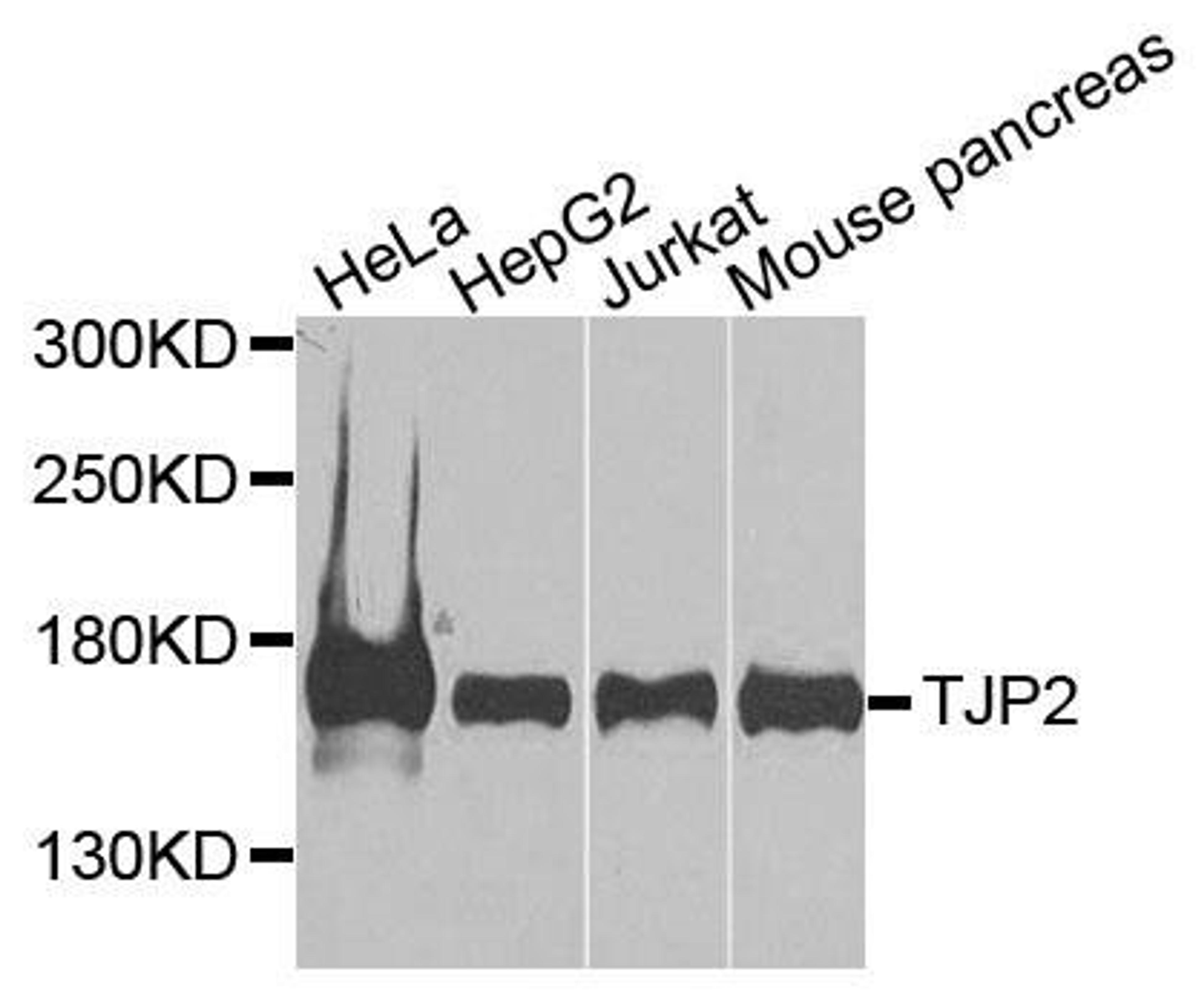 Western blot analysis of extracts of various cells using ZO-2 antibody