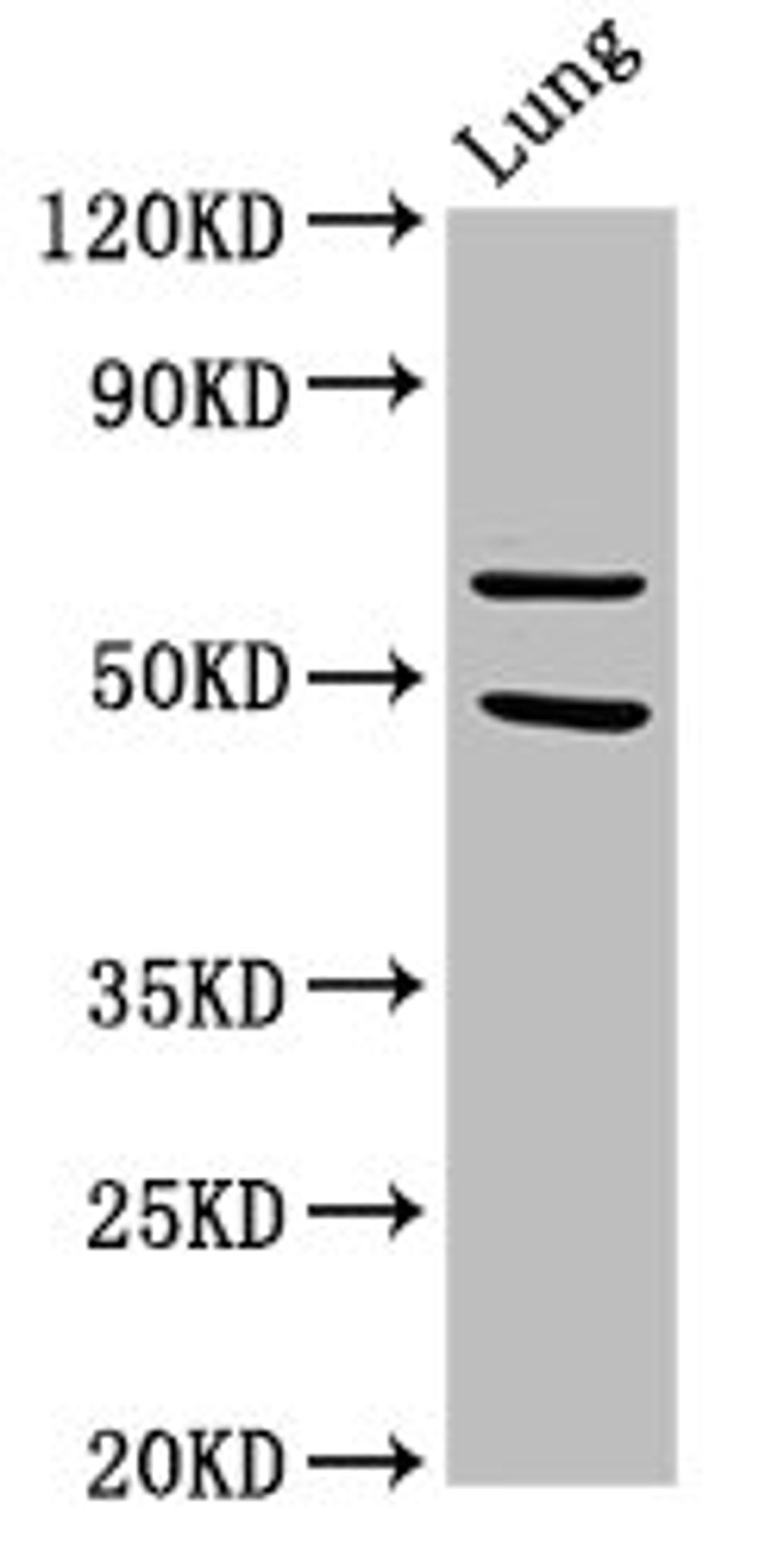 Western Blot. Positive WB detected in: Rat lung tissue. All lanes: PAK4 antibody at 3.2µg/ml. Secondary. Goat polyclonal to rabbit IgG at 1/50000 dilution. Predicted band size: 65, 48, 49, 55 kDa. Observed band size: 65 kDa