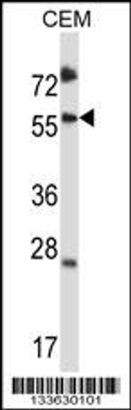 Western blot analysis in CEM cell line lysates (35ug/lane).