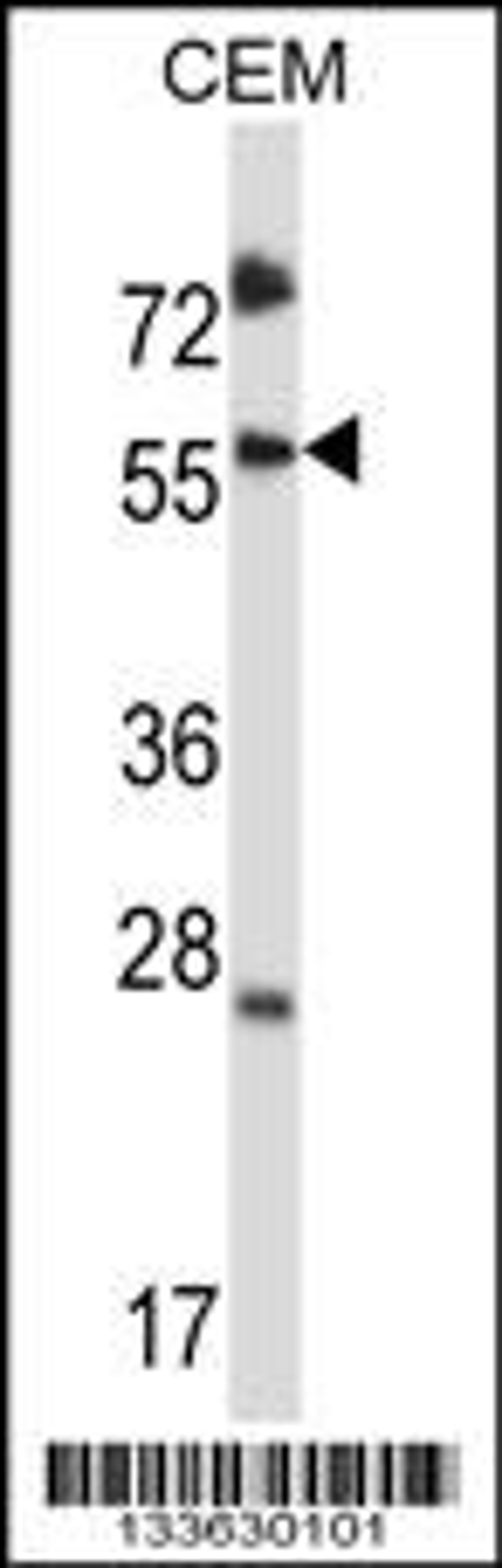 Western blot analysis in CEM cell line lysates (35ug/lane).