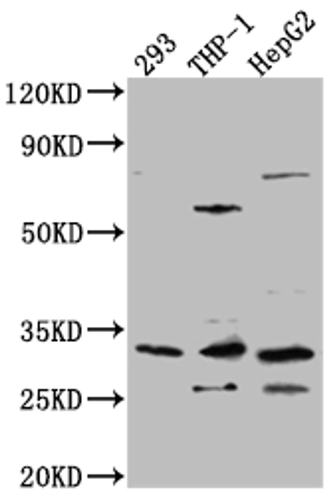 Western Blot. Positive WB detected in: 293 whole cell lysate, THP-1 whole cell lysate, HepG2 whole cell lysate. All lanes: COMT Antibody at 1:1000. Secondary. Goat polyclonal to rabbit IgG at 1/50000 dilution. Predicted band size: 31, 25 kDa. Observed band size: 31 kDa. 