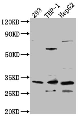 Western Blot. Positive WB detected in: 293 whole cell lysate, THP-1 whole cell lysate, HepG2 whole cell lysate. All lanes: COMT Antibody at 1:1000. Secondary. Goat polyclonal to rabbit IgG at 1/50000 dilution. Predicted band size: 31, 25 kDa. Observed band size: 31 kDa. 