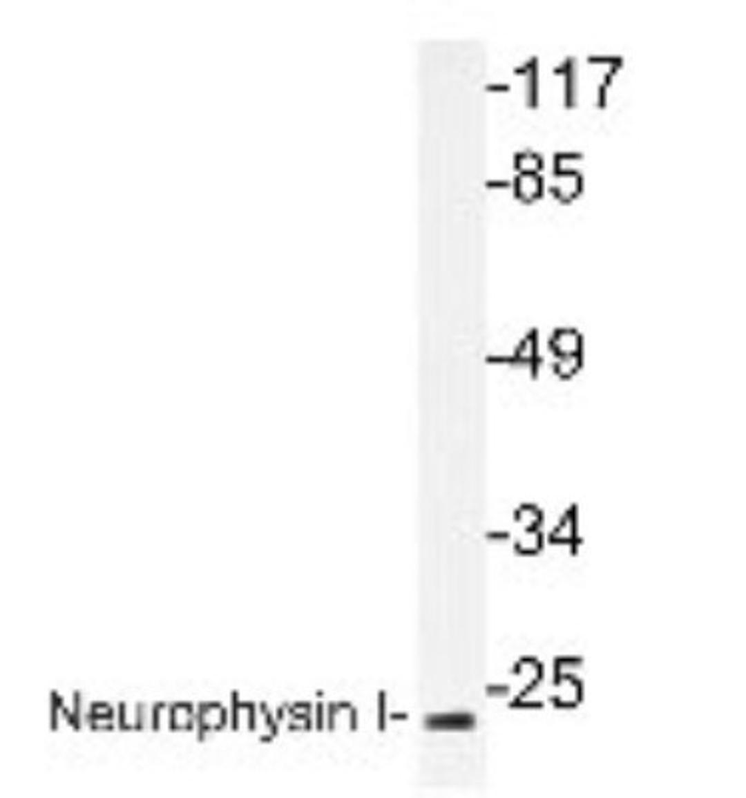 Western Blot: Oxytocin Antibody [NBP1-19753] - extracts from K562 cells.