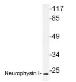 Western Blot: Oxytocin Antibody [NBP1-19753] - extracts from K562 cells.