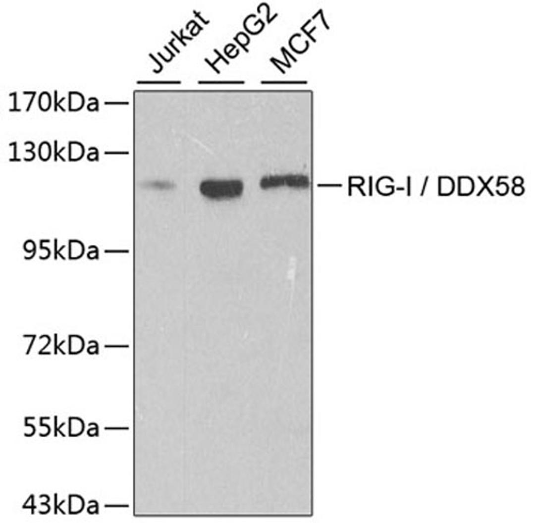 Western blot - RIG-I / DDX58 antibody (A0550)