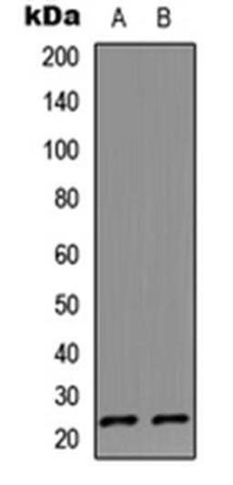 Western blot analysis of HeLa (Lane1), Jurkat (Lane2) whole cell using IL-17D antibody