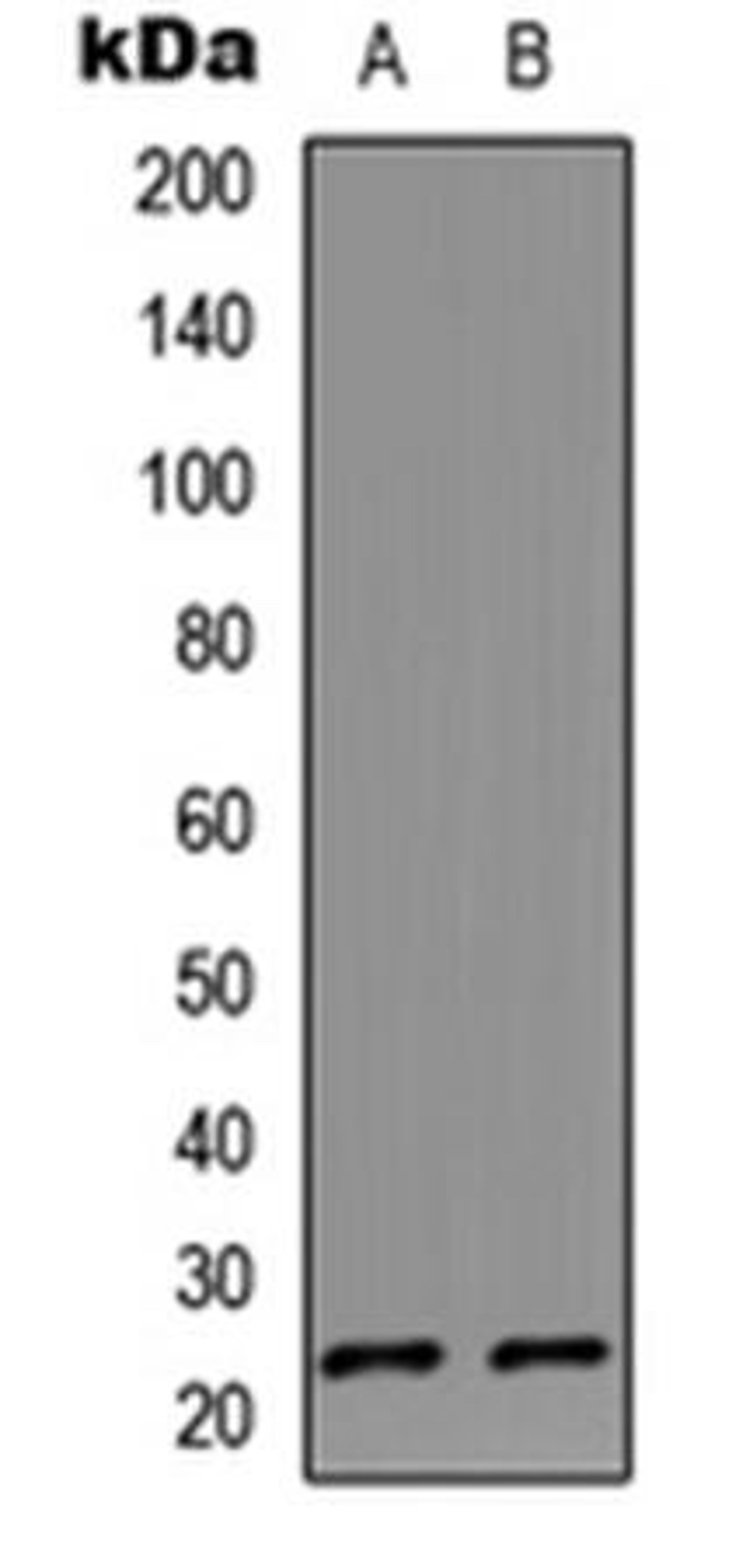 Western blot analysis of HeLa (Lane1), Jurkat (Lane2) whole cell using IL-17D antibody