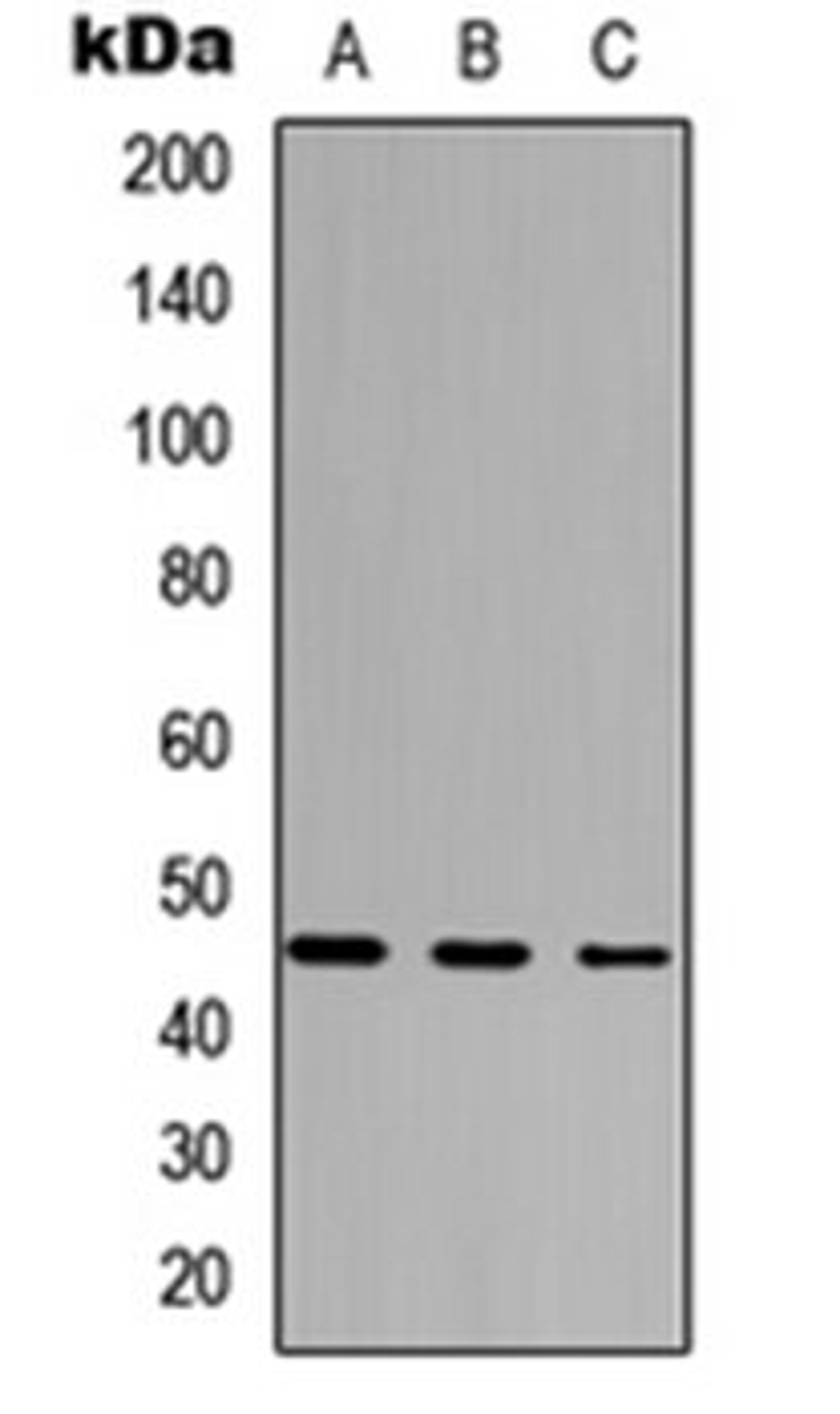 Western blot analysis of HEK293T (Lane 1), Raw264.7 (Lane 2), PC12 (Lane 3) whole cell lysates using FoxD4L5 antibody