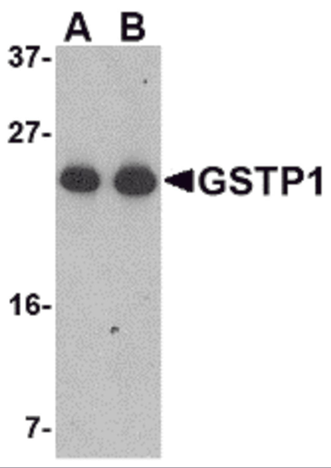 Western blot analysis of GSTP1 in Jurkat cell lysate with GSTP1 antibody at (A) 0.5 and (B) 1 μg/mL.