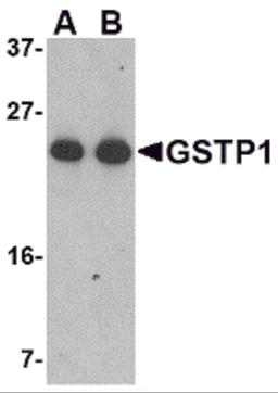 Western blot analysis of GSTP1 in Jurkat cell lysate with GSTP1 antibody at (A) 0.5 and (B) 1 μg/mL.