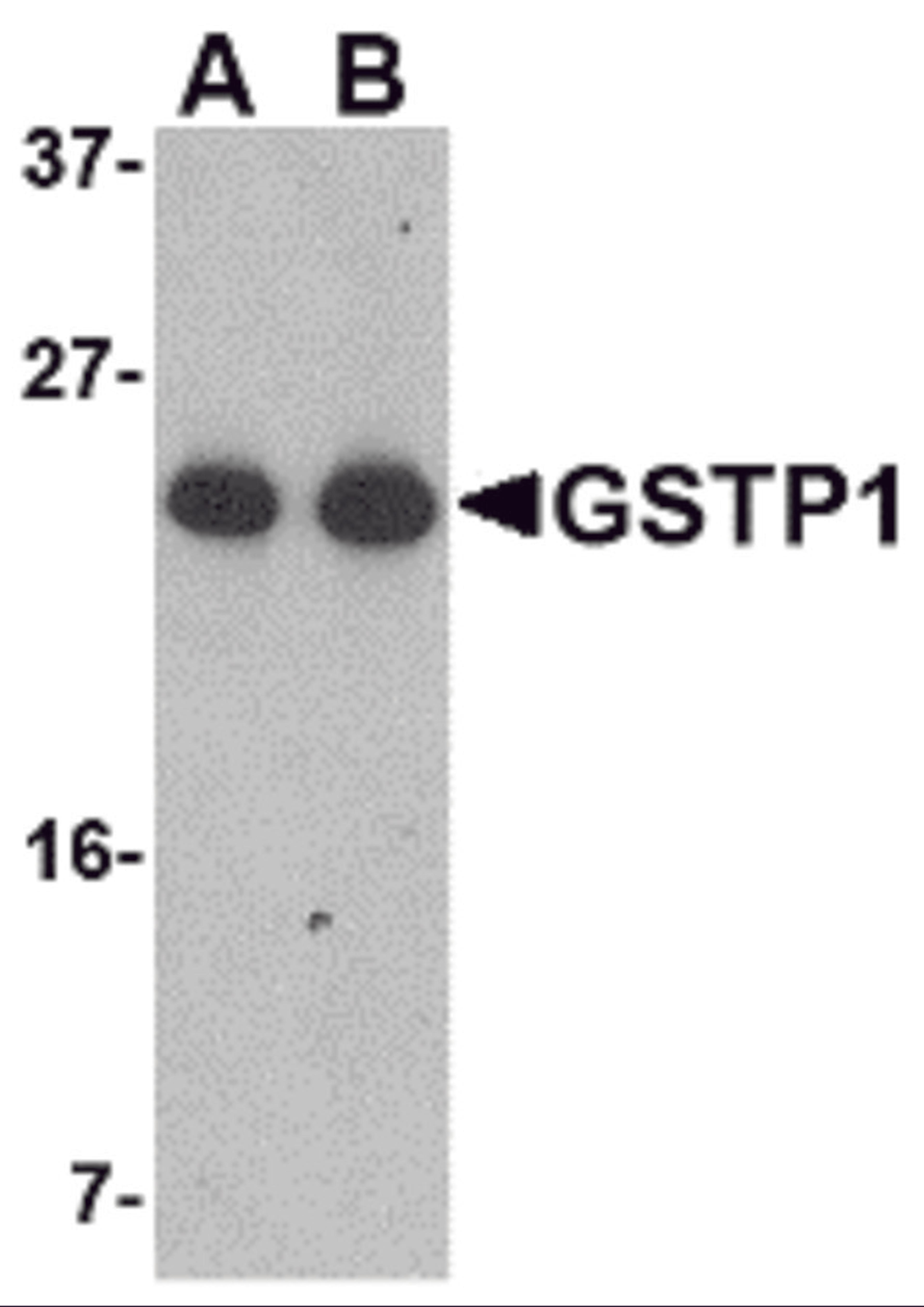 Western blot analysis of GSTP1 in Jurkat cell lysate with GSTP1 antibody at (A) 0.5 and (B) 1 μg/mL.