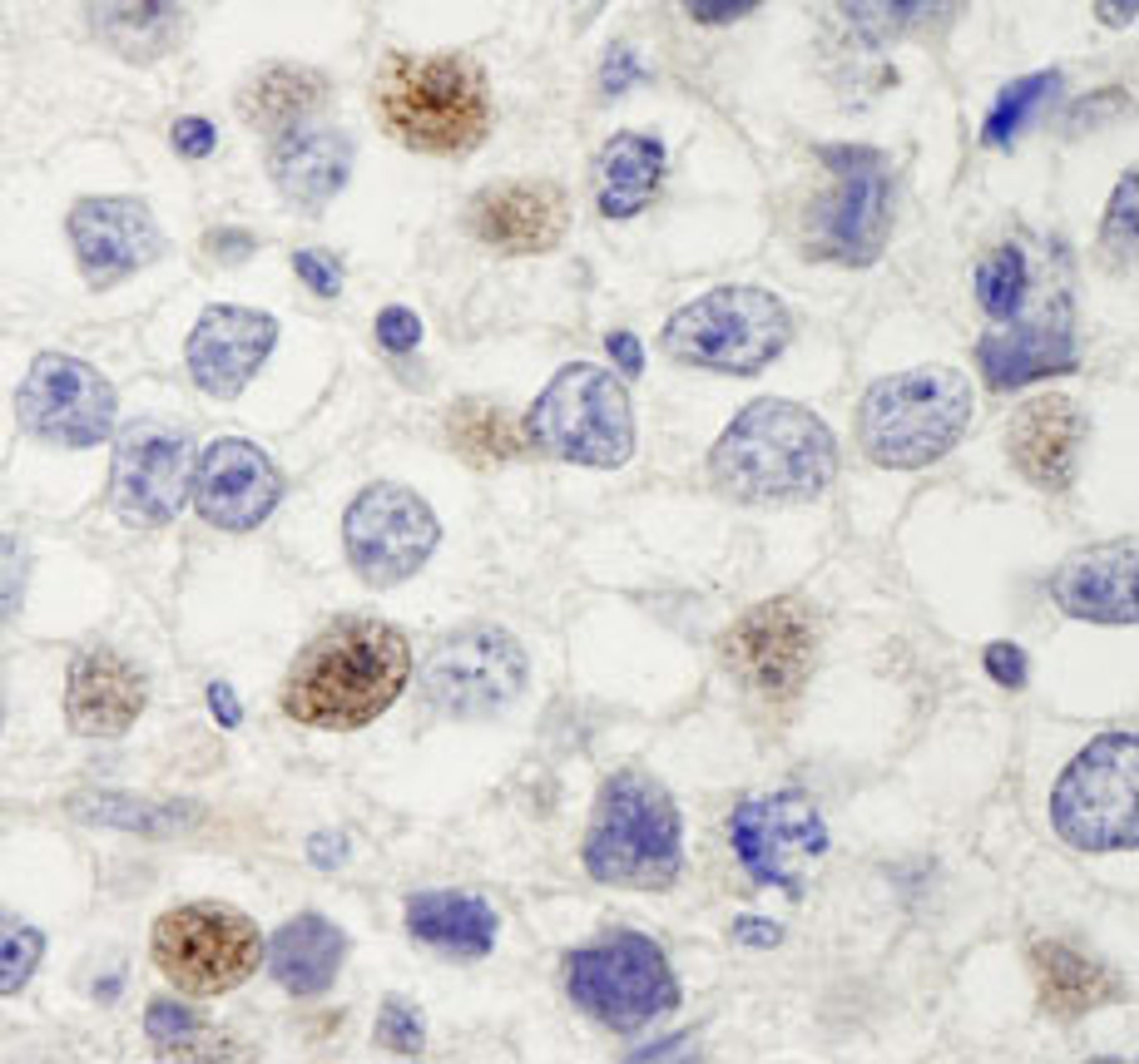 Detection of human HURP/DLG7 by immunohistochemistry.