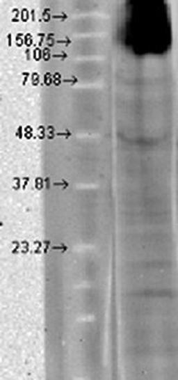 Western blot analysis of T-HEK cells using HCN4 antibody