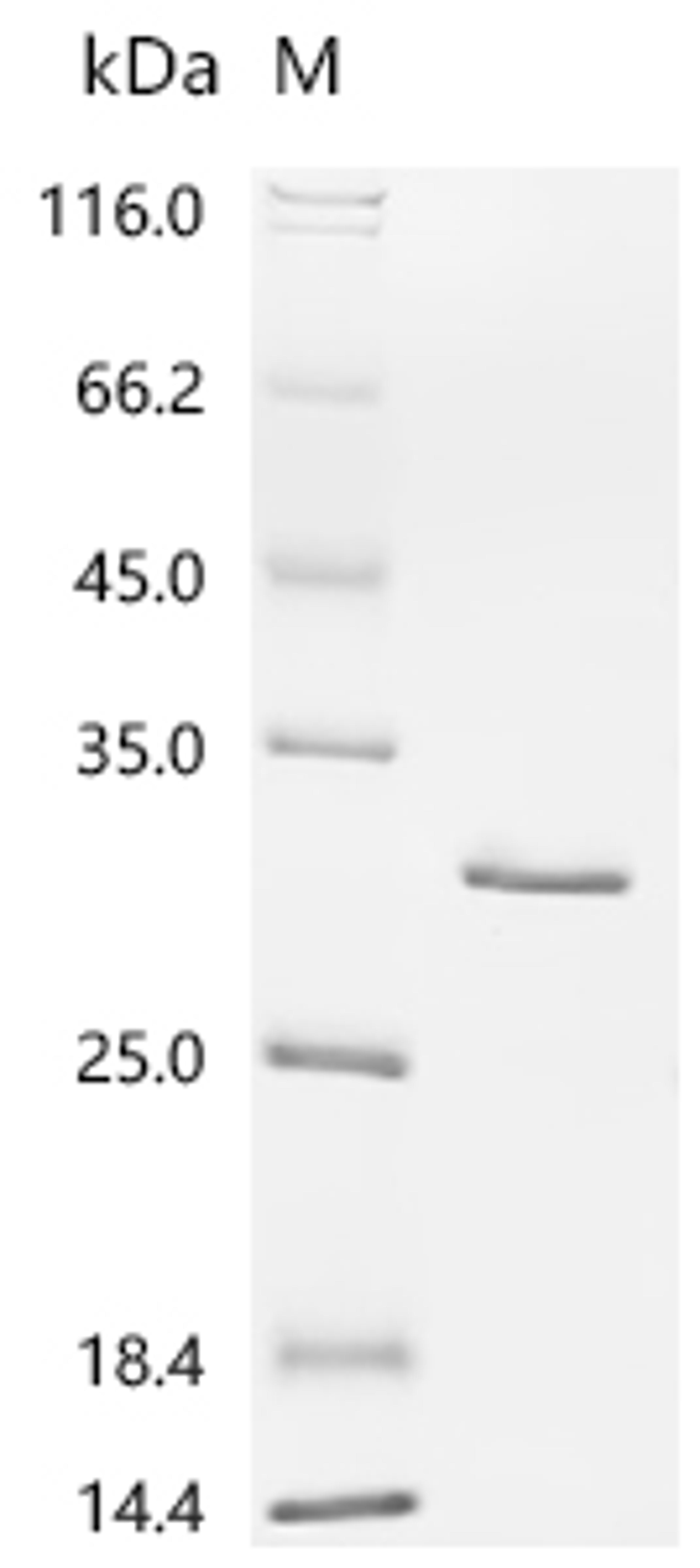 (Tris-Glycine gel) Discontinuous SDS-PAGE (reduced) with 5% enrichment gel and 15% separation gel.