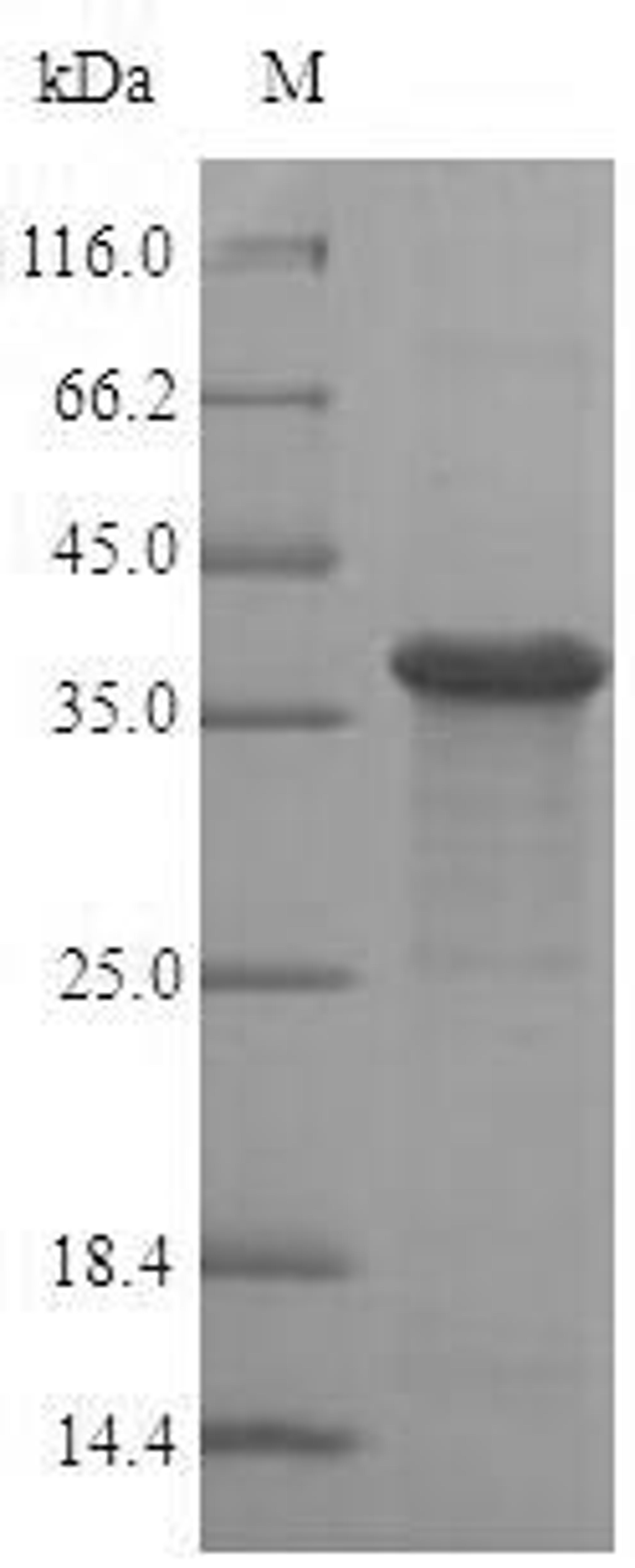 (Tris-Glycine gel) Discontinuous SDS-PAGE (reduced) with 5% enrichment gel and 15% separation gel.